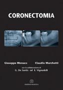 Coronectomia