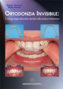 Ortodonzia Invisibile