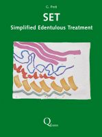 SET Simplified Edentulous Treatment