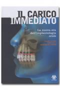 Il carico immediato - La nuova era dell' implantologia orale
