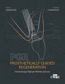 PGR: Prosthetically Guided Regeneration - Implantologia digitale multidisciplinare