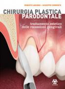 Chirurgia Plastica Parodontale - Trattamento estetico delle recessioni gengivali