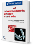 Trattamento Ortodontico e Chirurgico dei Denti Inclusi
