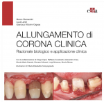 ALLUNGAMENTO DI CORONA CLINICA  Razionale biologico e applicazione clinica