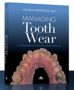 Managing Tooth Wear - A comprensive Guide for General Practice