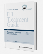 Guida al trattamento ITI - Vol. 13 - Prevenzione e trattamento della perimplantite