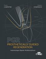 PGR: Prosthetically Guided Regeneration - Implantologia digitale multidisciplinare
