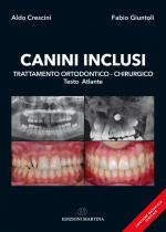 Canini Inclusi - Trattamento ortodontico - chirurgico - Testo Atlante