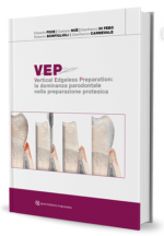 VEP - VERTICAL EDGELESS PREPARATION: La Dominanza Parodontale nella Preparazione Protesica
