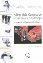 Atlante delle Complicanze e degli Insuccessi in Implantologia