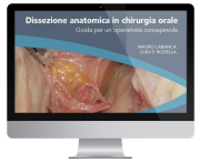 VIDEO CORSO " DISSEZIONE ANATOMICA IN CHIRURGIA ORALE " ( Dr. Labanca - Dr. Rodella )