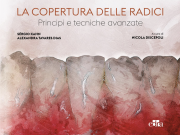 La Copertura delle Radici - Principi e Tecniche Avanzate + Video con QRCODE