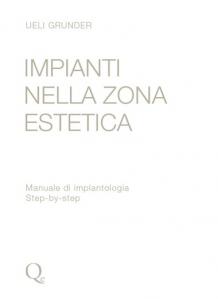 Grunder - Impianti nella zona Estetica - Manuale di Implantologia Step by Step