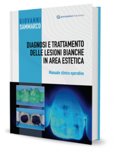 Diagnosi e Trattamento delle Lesioni Bianche in Area Estetica - Manuale clinico operativo ( Dr. G. Sammarco )