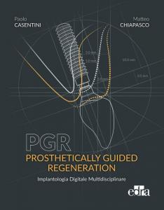 PGR: Prosthetically Guided Regeneration - Implantologia digitale multidisciplinare