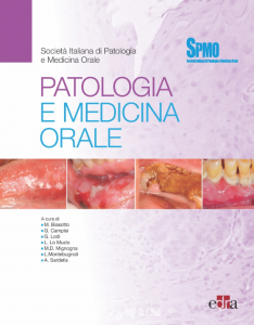 Patologia e Medicina Orale - SIPMO ( Società Italiana di Patologia e Medicina Orale )
