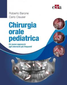 Chirurgia Orale Pediatrica - Un nuovo approccio agli interventi più frequenti