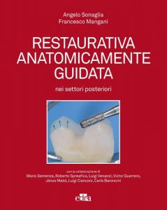 Restaurativa Anatomicamente Guidata nei settori Posteriori