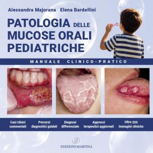 PATOLOGIA DELLE MUCOSE ORALI PEDIATRICHE. Manuale Clinico-Pratico