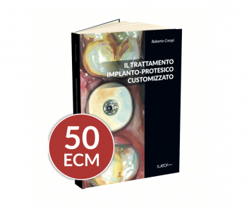 Il Trattamento Implanto - Protesico Customizzato ( + 50 CREDITI ECM )