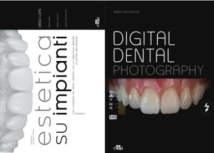 Estetica su Impianti + Digital Dental Photography